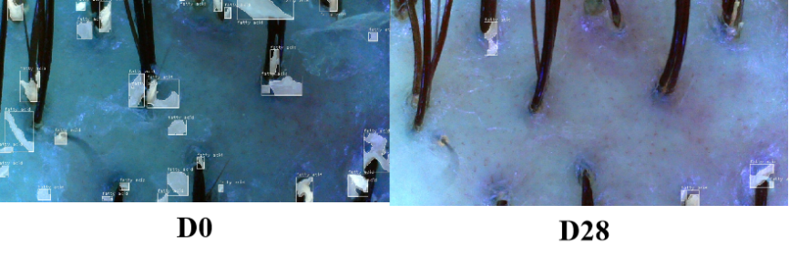 Scalp,health,Cosmetc,Efficacy,Evaluation