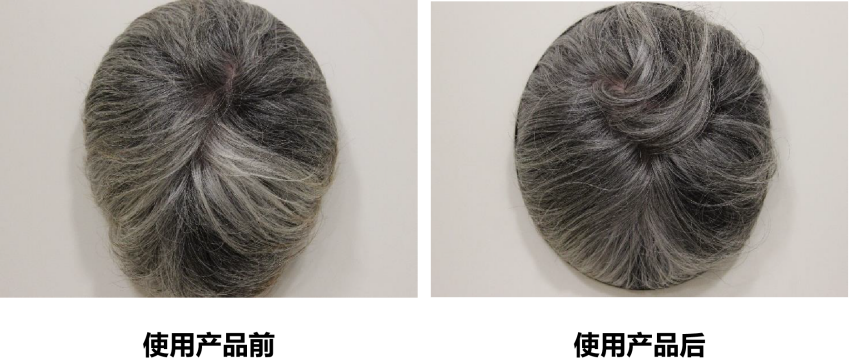 頭皮健康,紅斑,,丘疹,膿皰,評(píng)價(jià)方法