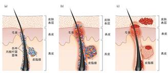 敏感肌,皮膚,敏感